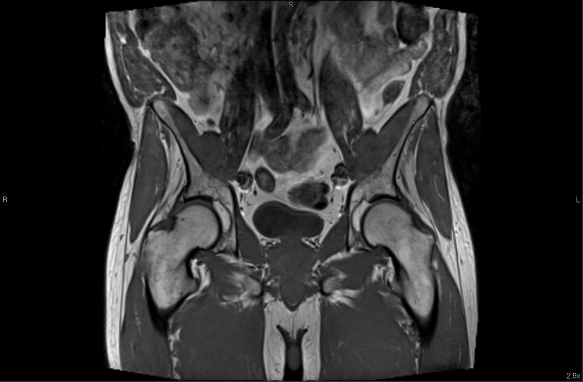 MRI CT Combination - The Radiology Clinic