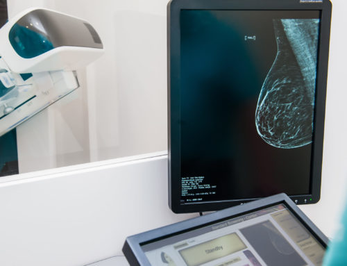 Everything You Need to Know About Screening Mammograms